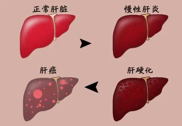 开云体育 开云官网院士呼吁：停止饮用1“